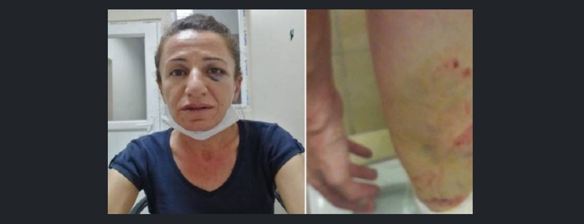 On the detentions and arrests against the HDP and unlawful closure of the Democratic Society Congress
